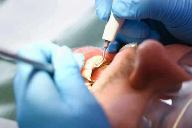 Best Cracked Tooth Emergency Dentist  in Blythewood, SC